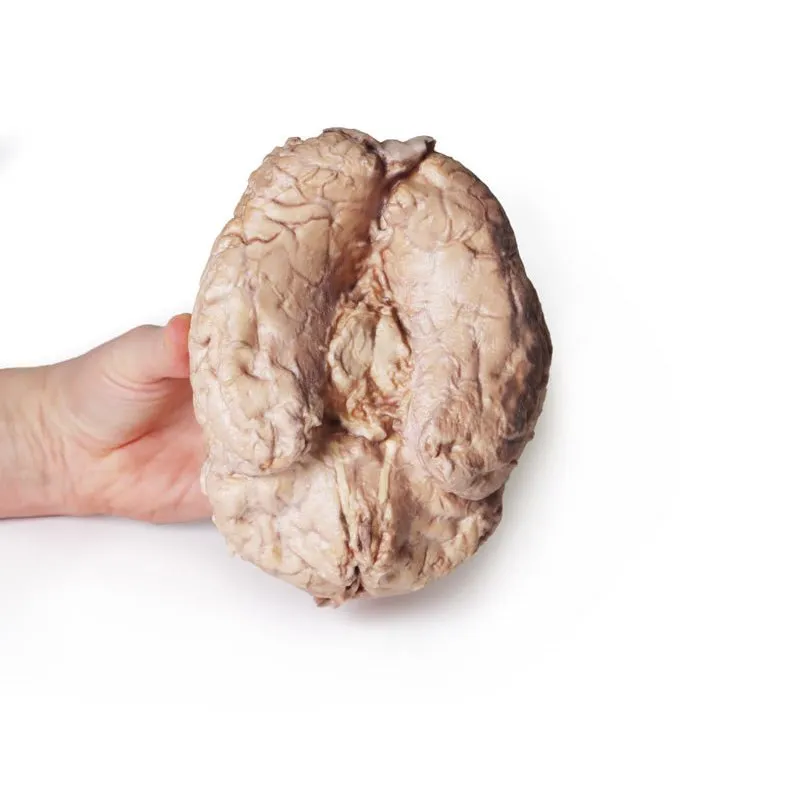 3D Printed Brain (Cerebrum)