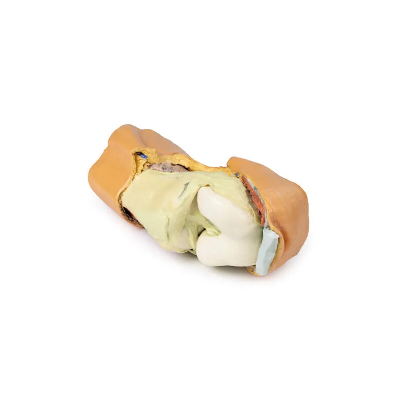 3D Printed Flexed knee joint deep dissection Model