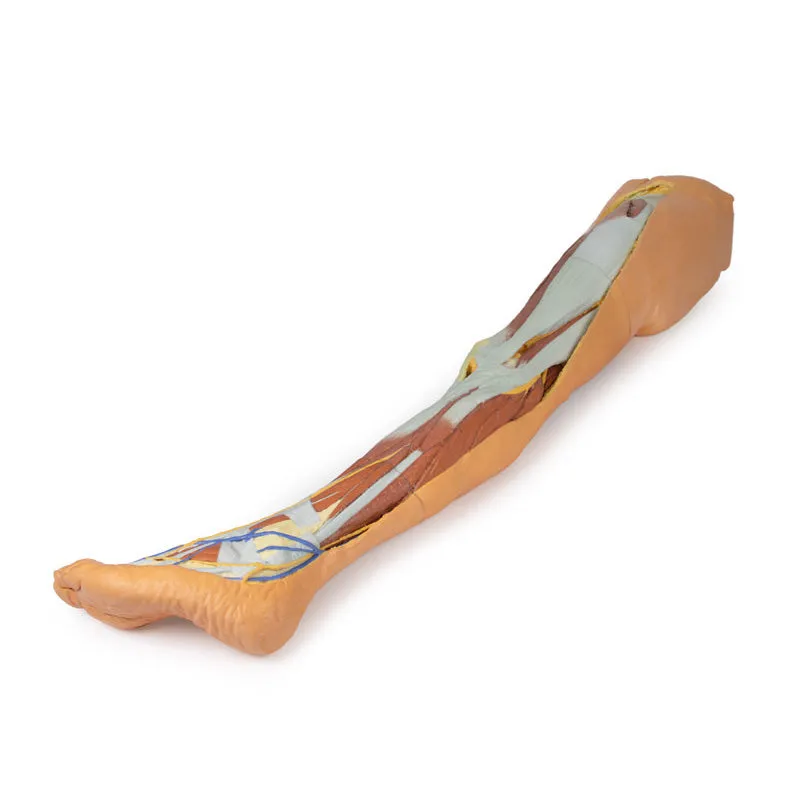 3D Printed Lower Limb - Superficial Dissection with Male Left Pelvis