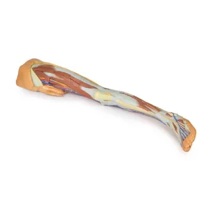 3D Printed Lower Limb - Superficial Dissection with Male Left Pelvis
