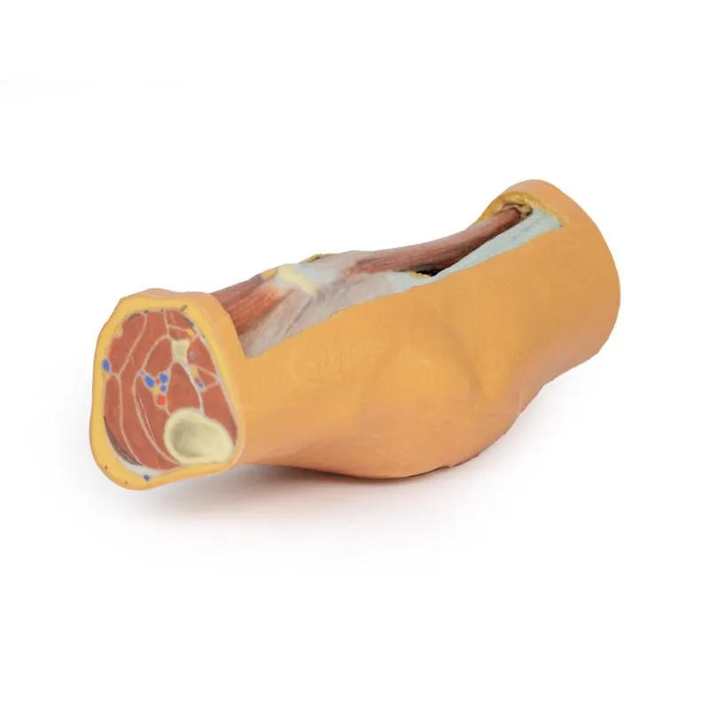 3D Printed Popliteal Fossa distal thigh and proximal leg