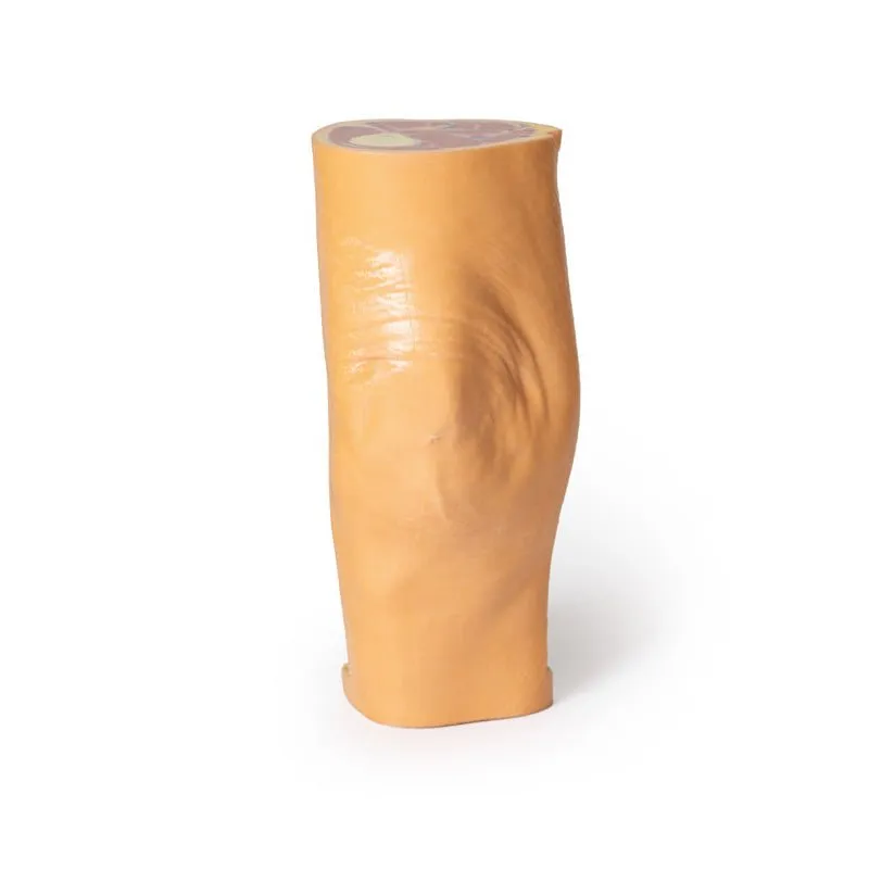 3D Printed Popliteal Fossa distal thigh and proximal leg