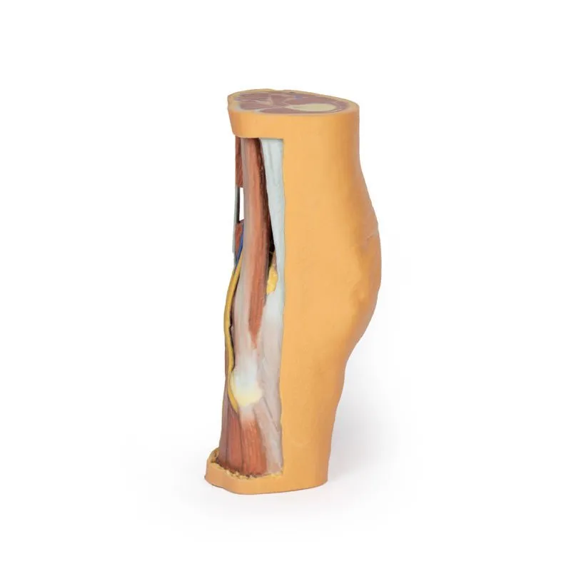 3D Printed Popliteal Fossa distal thigh and proximal leg
