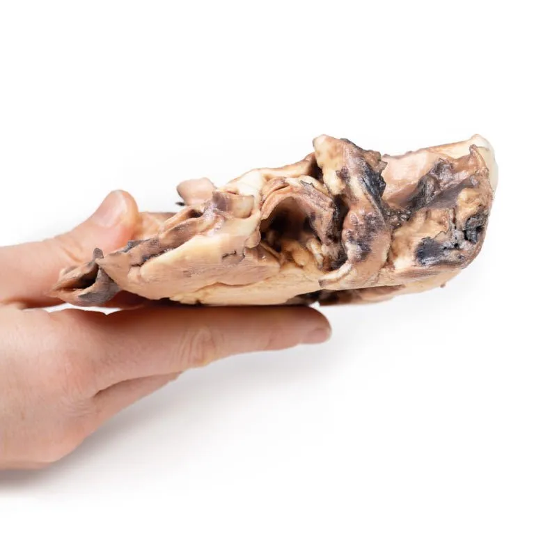 3D Printed Rheumatic Endocarditis