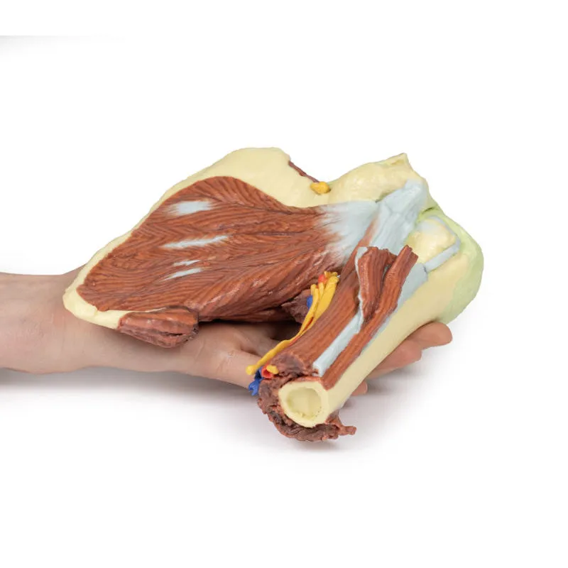 3D Printed Shoulder with deep dissection of the left shoulder