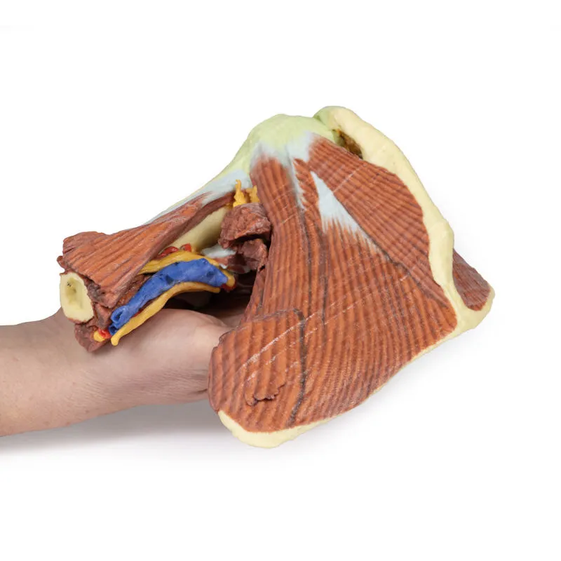 3D Printed Shoulder with deep dissection of the left shoulder