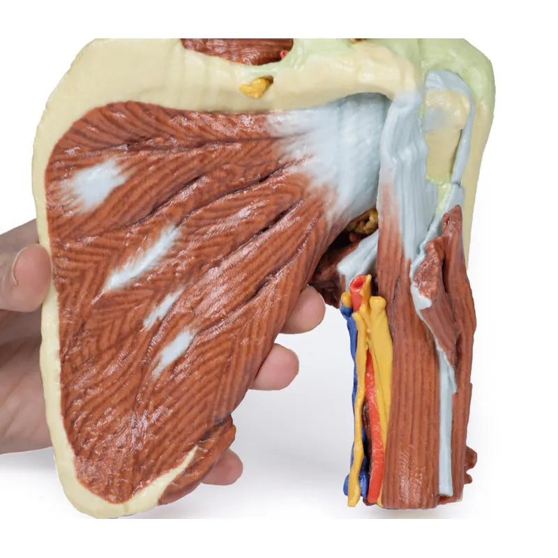3D Printed Shoulder with deep dissection of the left shoulder